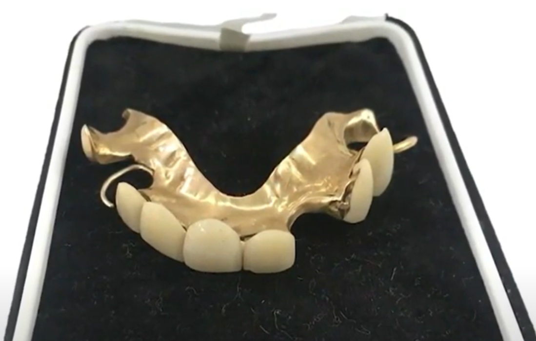 Screenshot of Winston Churchill's false teeth.