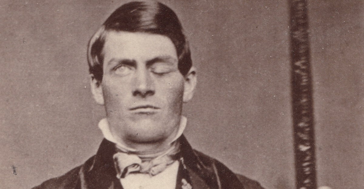 Cabinet-card portrait of brain-injury survivor Phineas P. Gage (1823–1860), shown holding the tamping iron which injured him