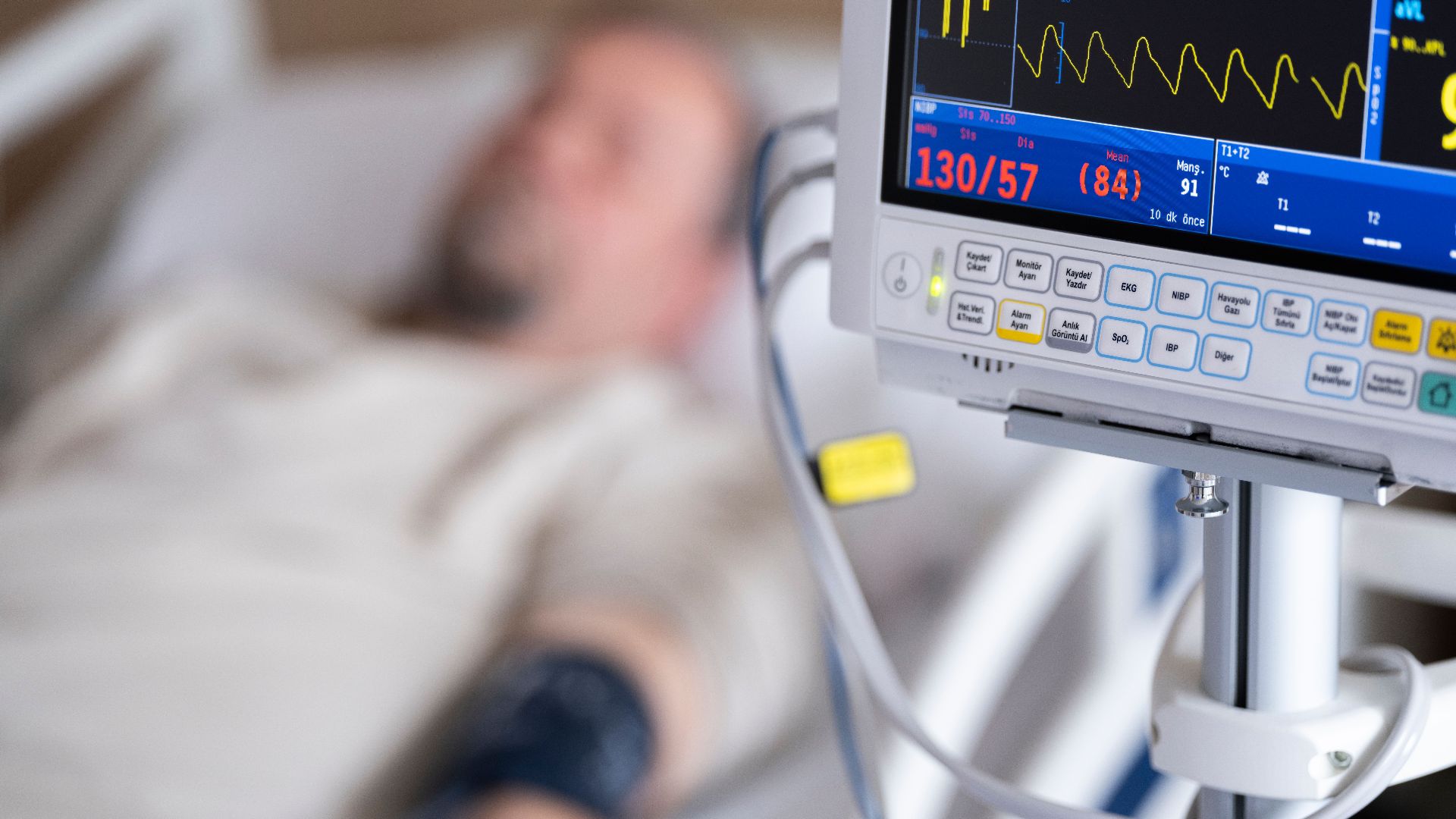 Patient in hospital bed with heart monitor showing blood pressure and heart rate.