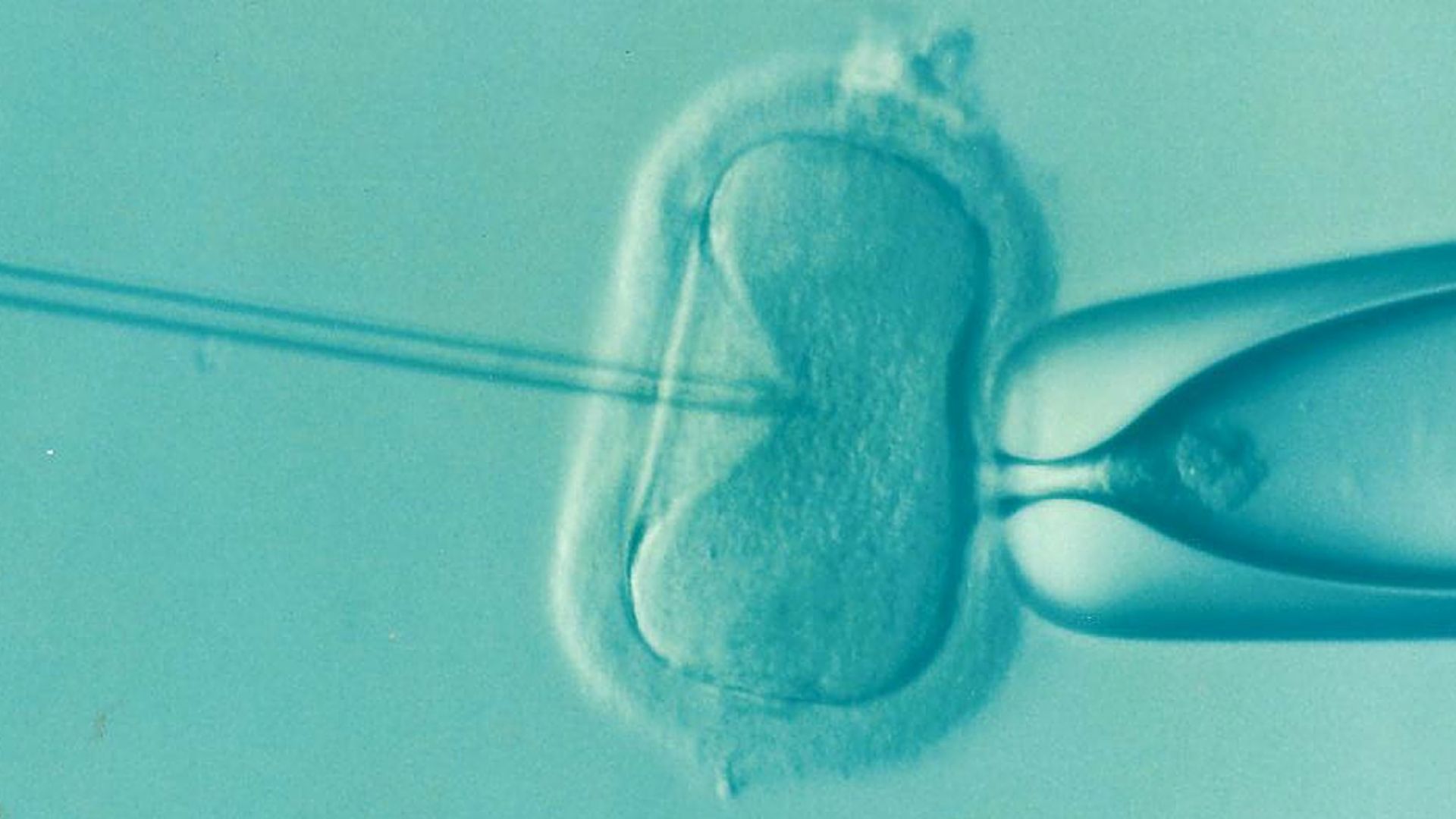 IVF example