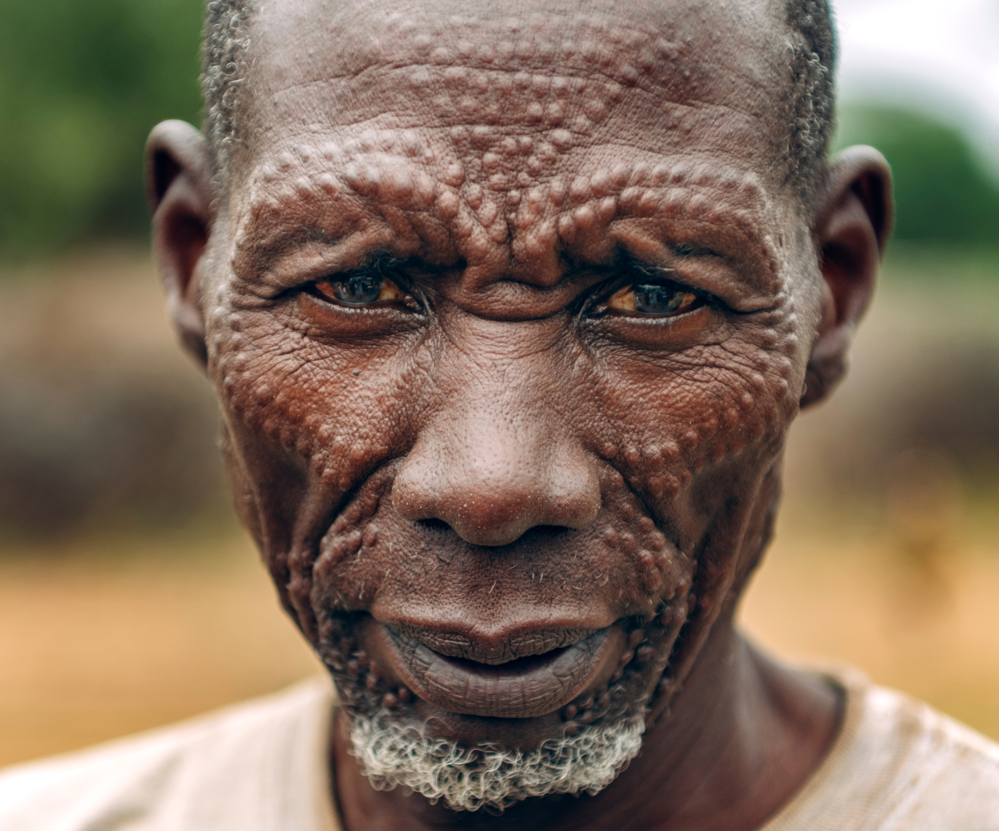 Toposa Tribe men with scars