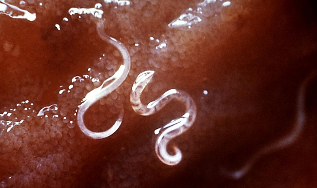 Hookworms