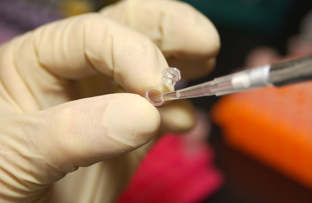 Close Up Photo of researcher uses a pipette to remove DNA