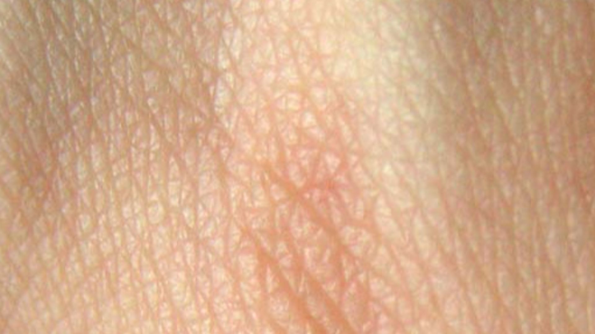 File:Human skin structure.jpg
