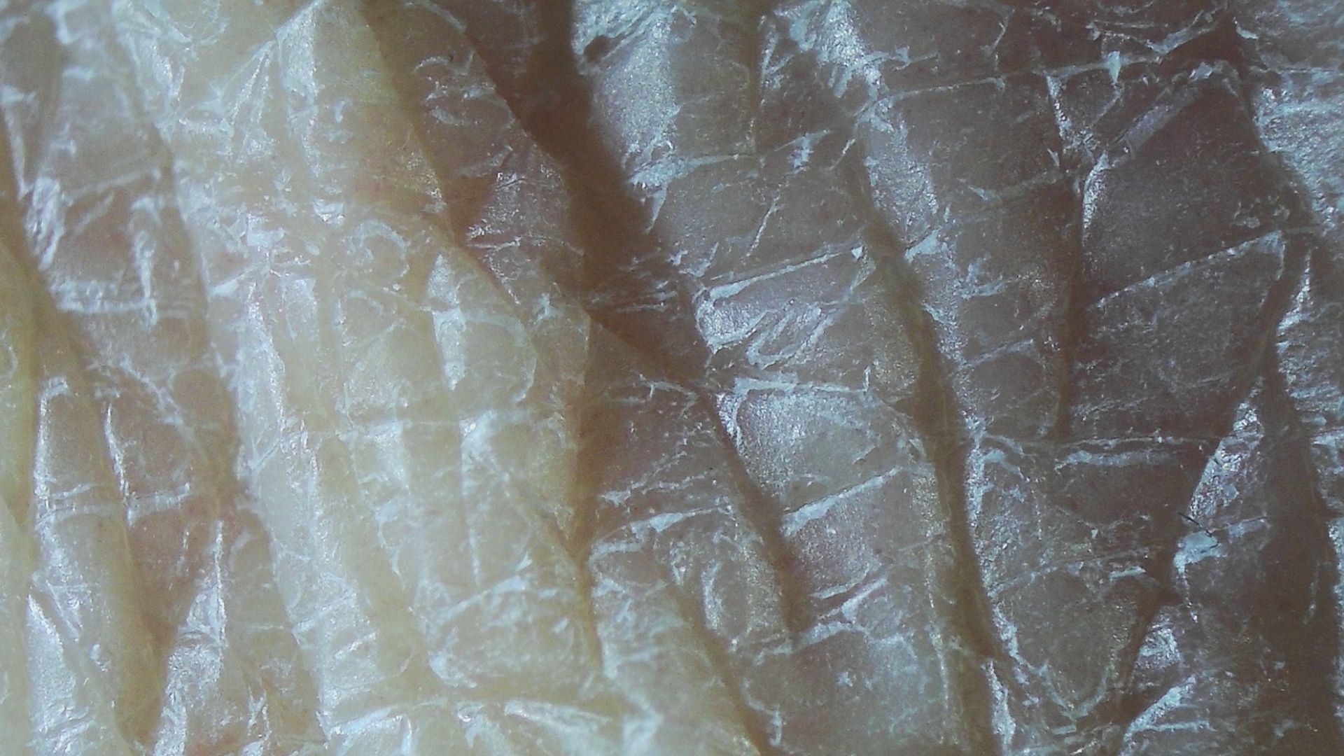 File:Hand skin closeup.jpg