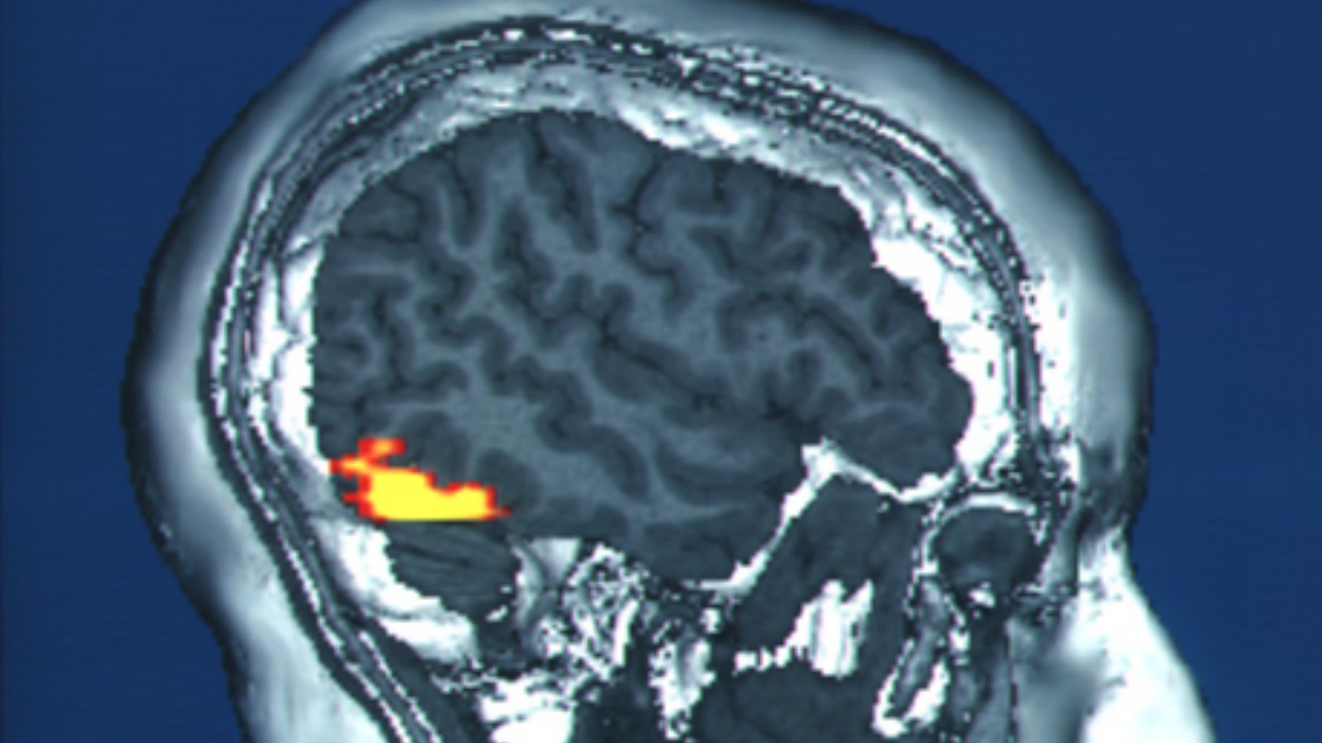 File:Fusiform face area face recognition.jpg