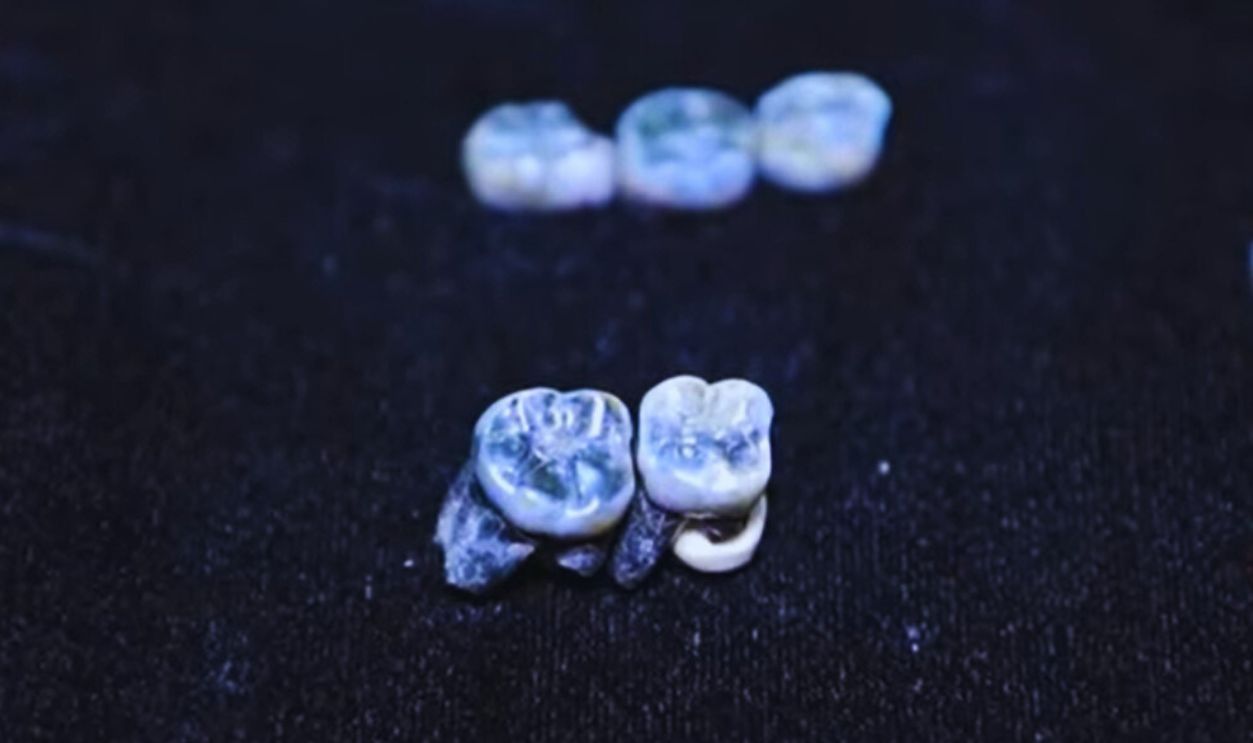 Teeth of new human ancestor 