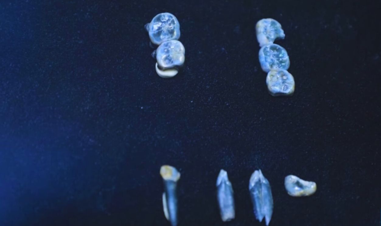 Teeth that shake up human evolution