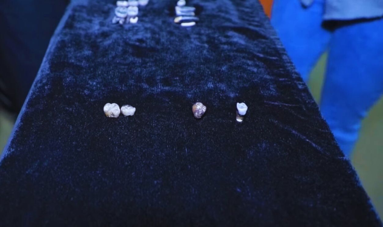 Teeth that shake up human evolution