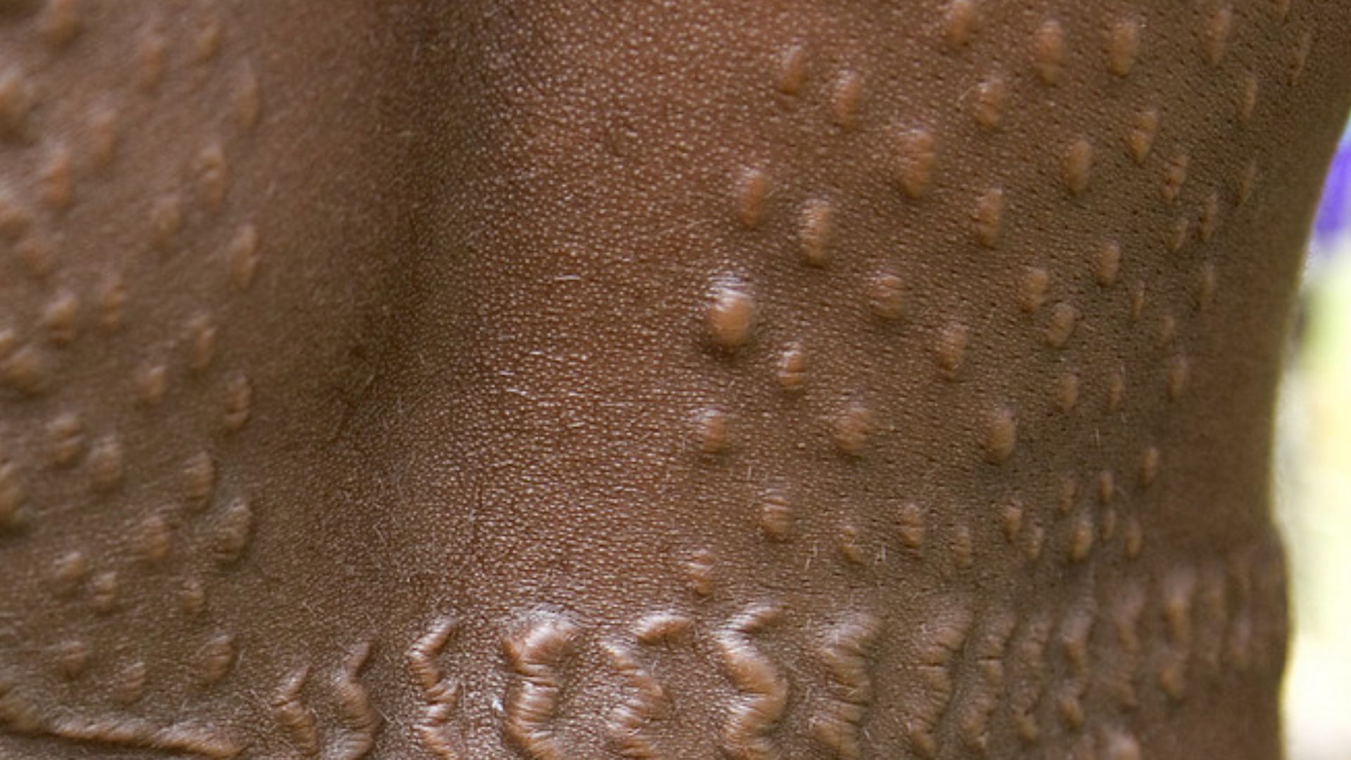 File:Tribal crocodile scarification, Sepik River, Papua New Guinea.jpg