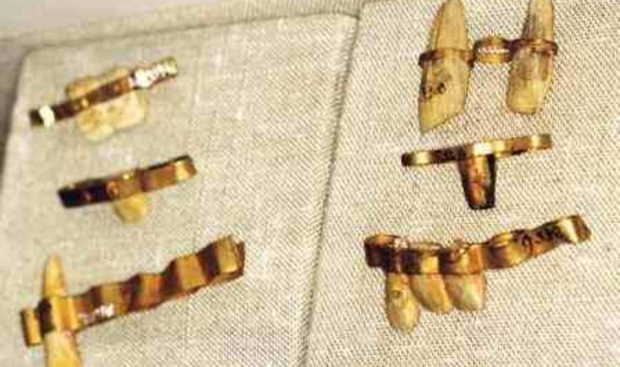 Ancient Egypt Dentistry