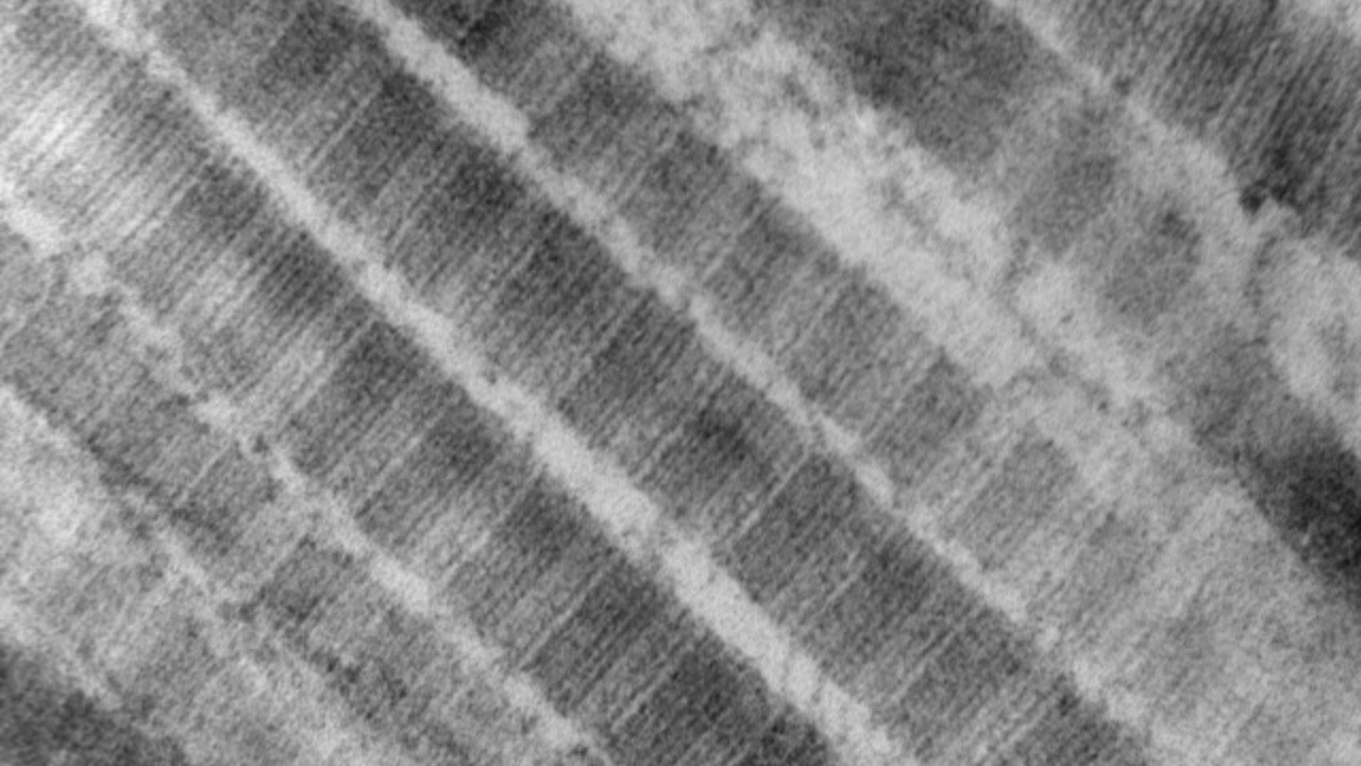 File:Fibers of Collagen Type I - TEM .jpg