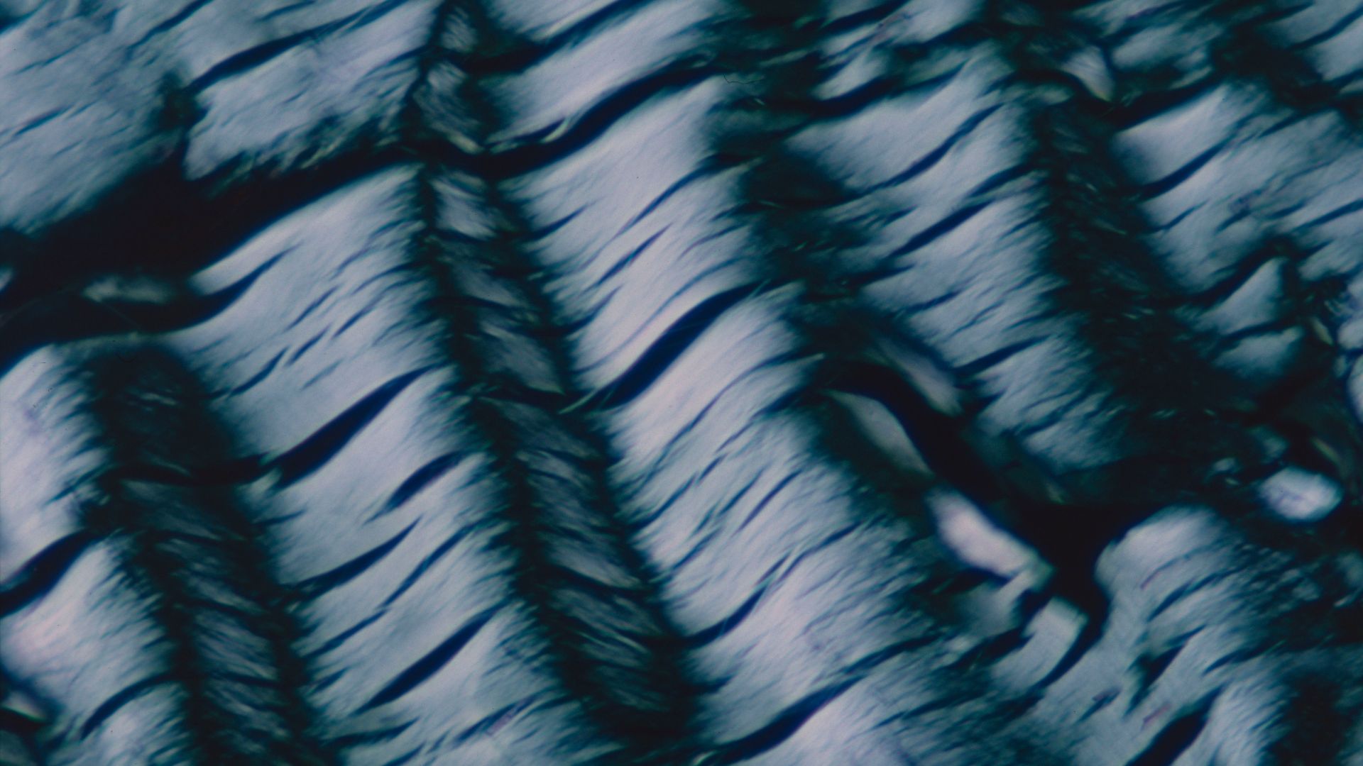 File:Wavy collagen.jpg