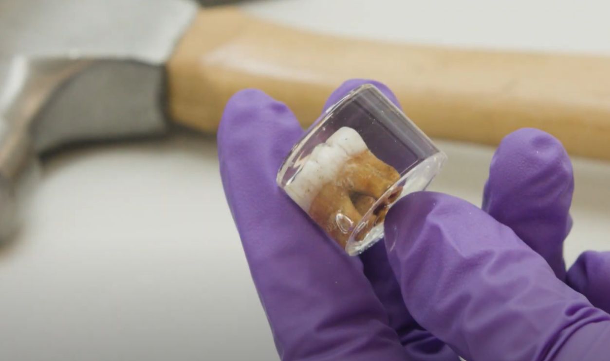 Discovery Of A Neanderthal Milk Tooth