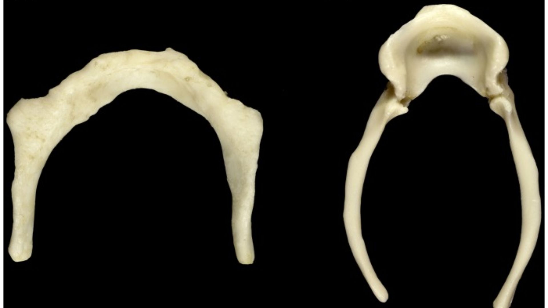 File:Male-Homo-sapiens-and-Pan-troglodytes-hyoid-bones.jpg
