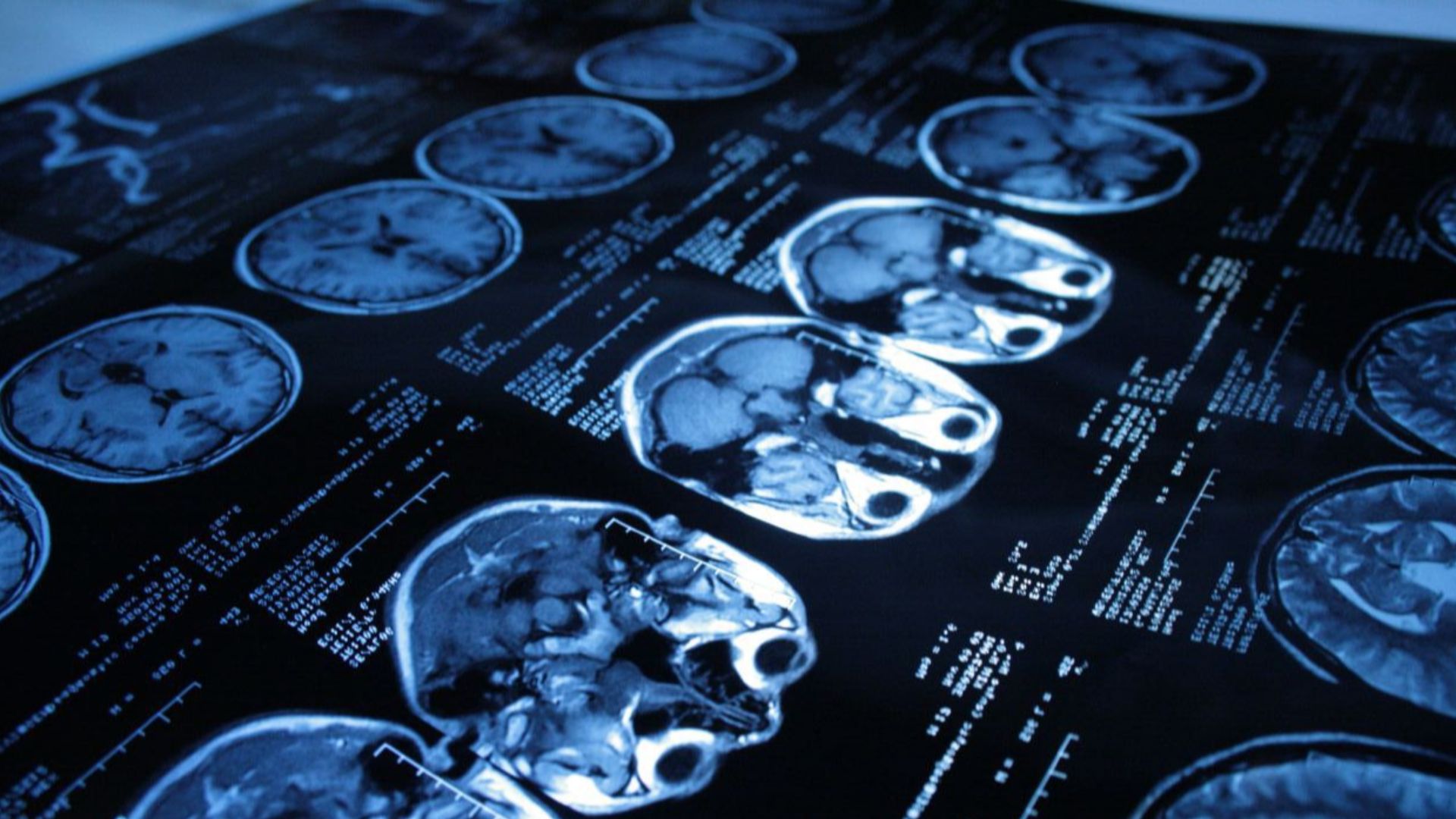 File:Computed tomography 2.png