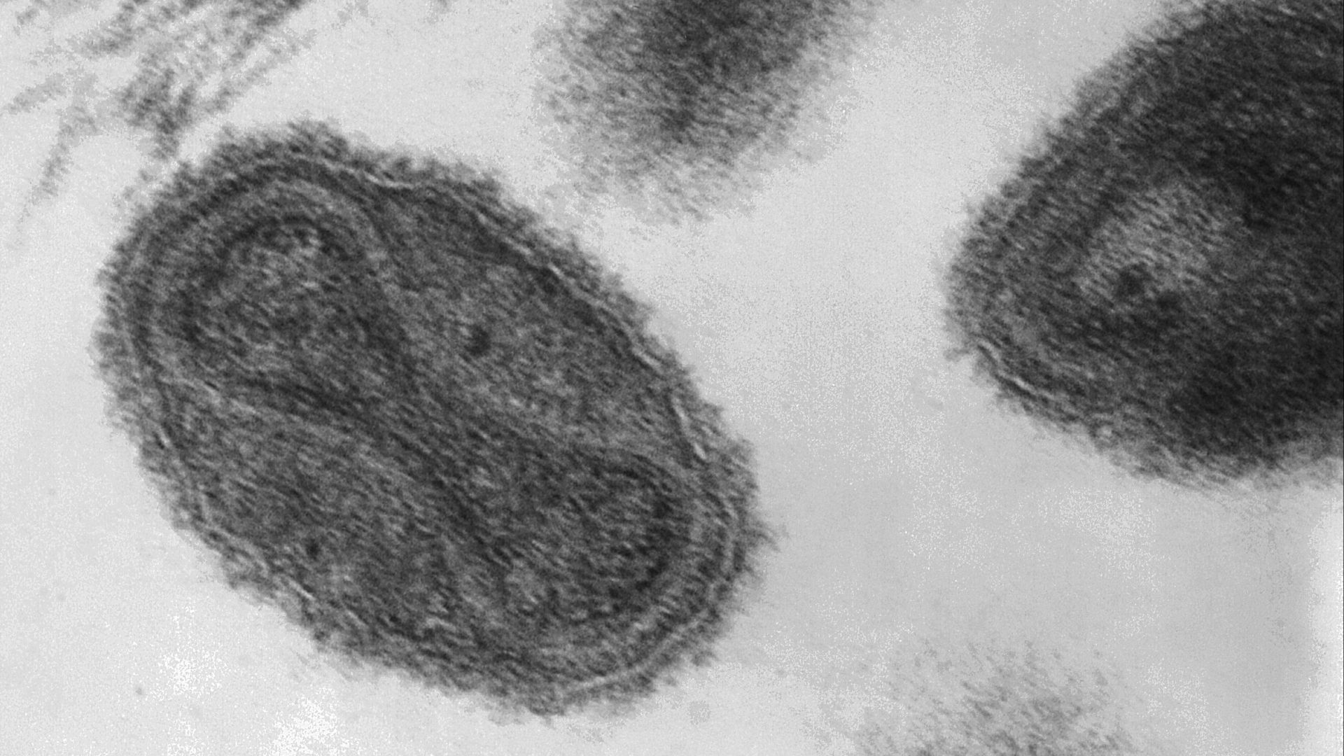 File:Smallpox virus virions TEM PHIL 1849 (crop).png