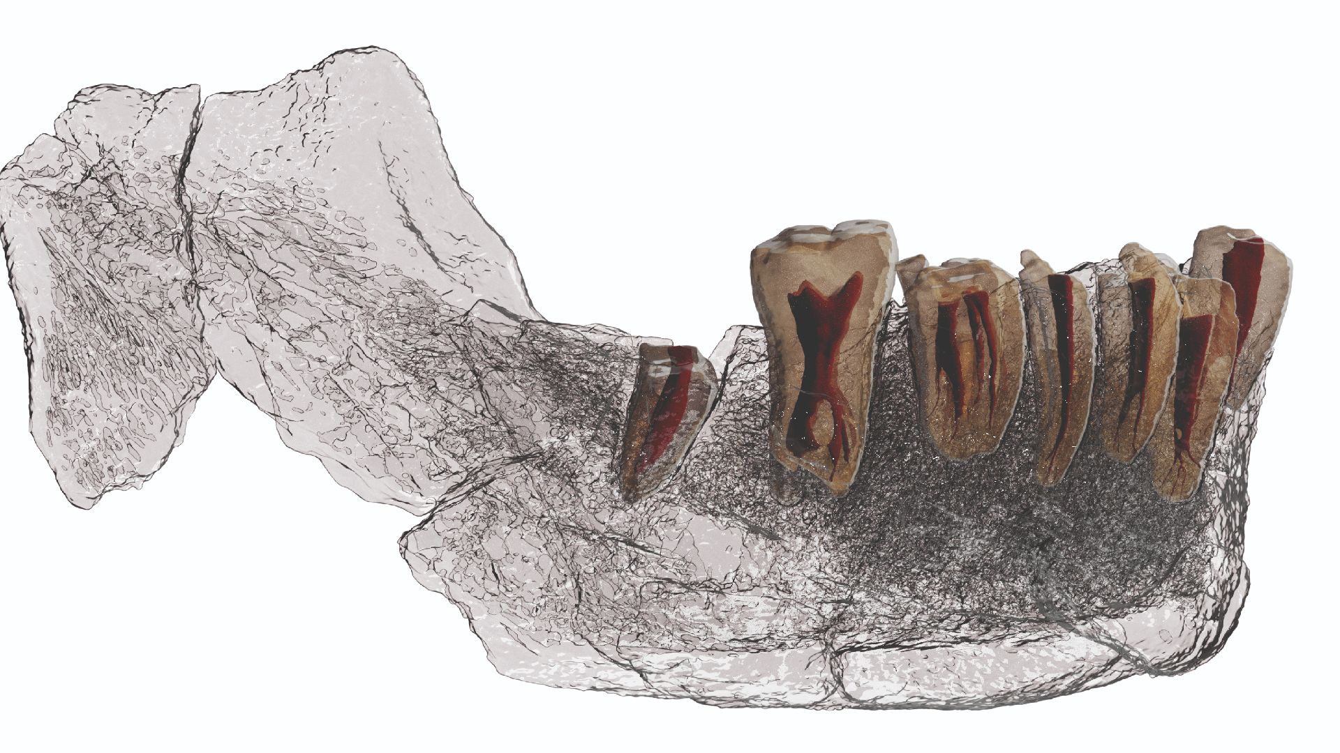 File:Scan of the mandible (lower jaw) Nesher Ramla 2.jpg