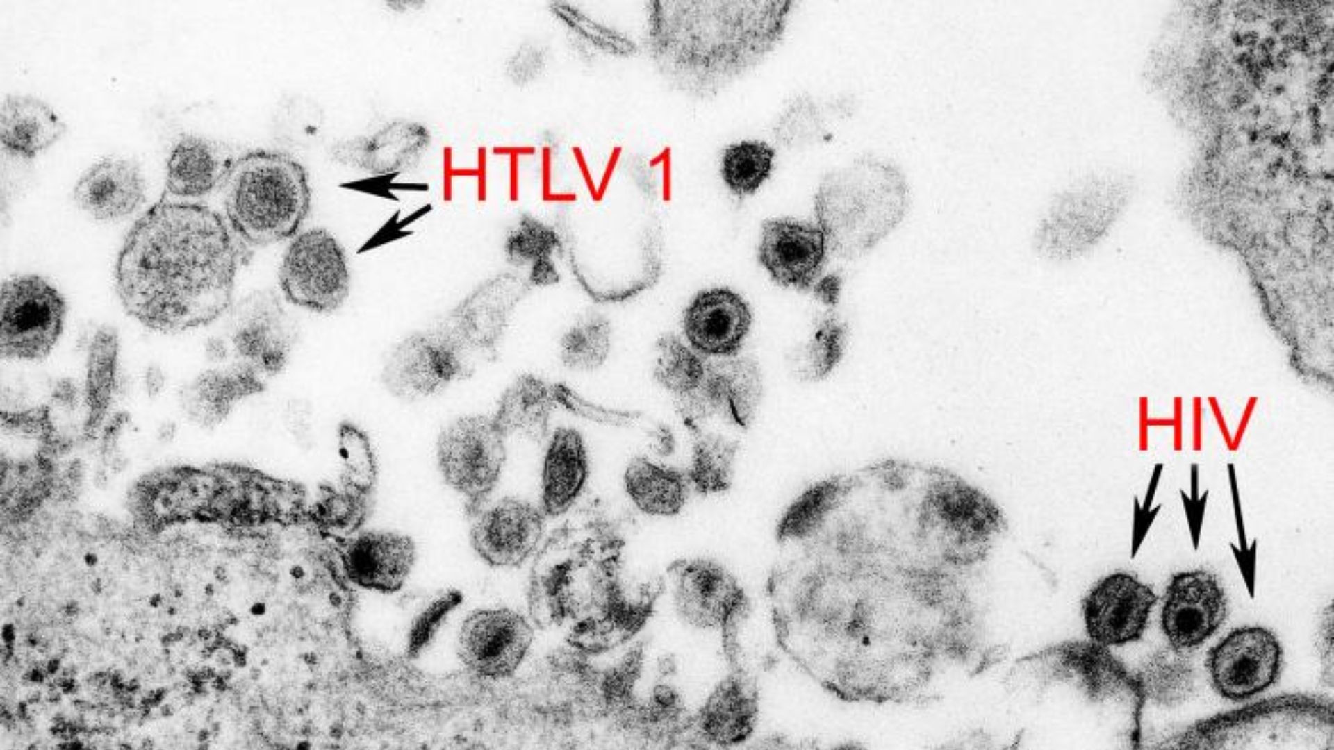File:HTLV-1 and HIV-1 EM 8241 lores.jpg