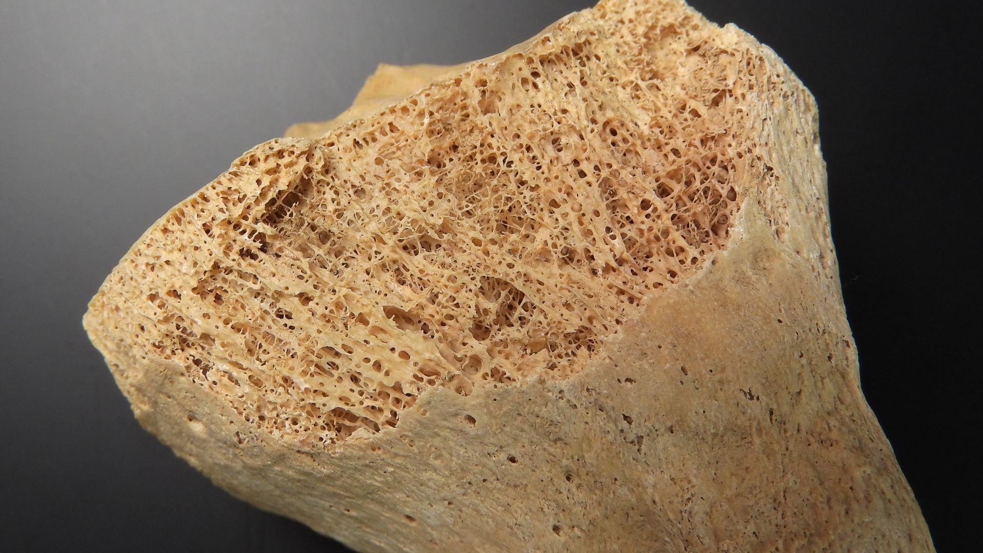 File:Tibia - detail of bone tissue (proximal end) 2.jpg