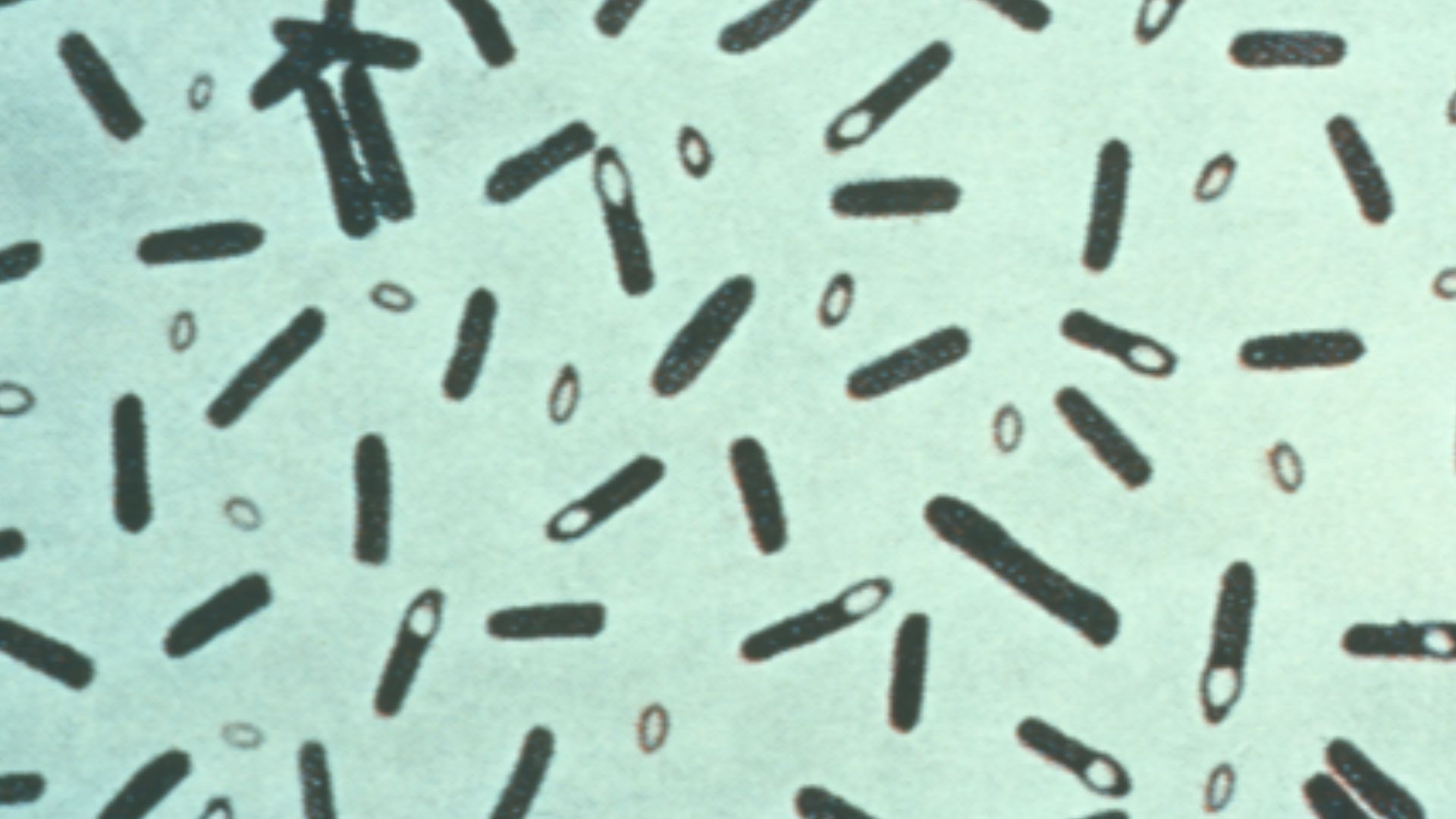File:Clostridium botulinum 01.png