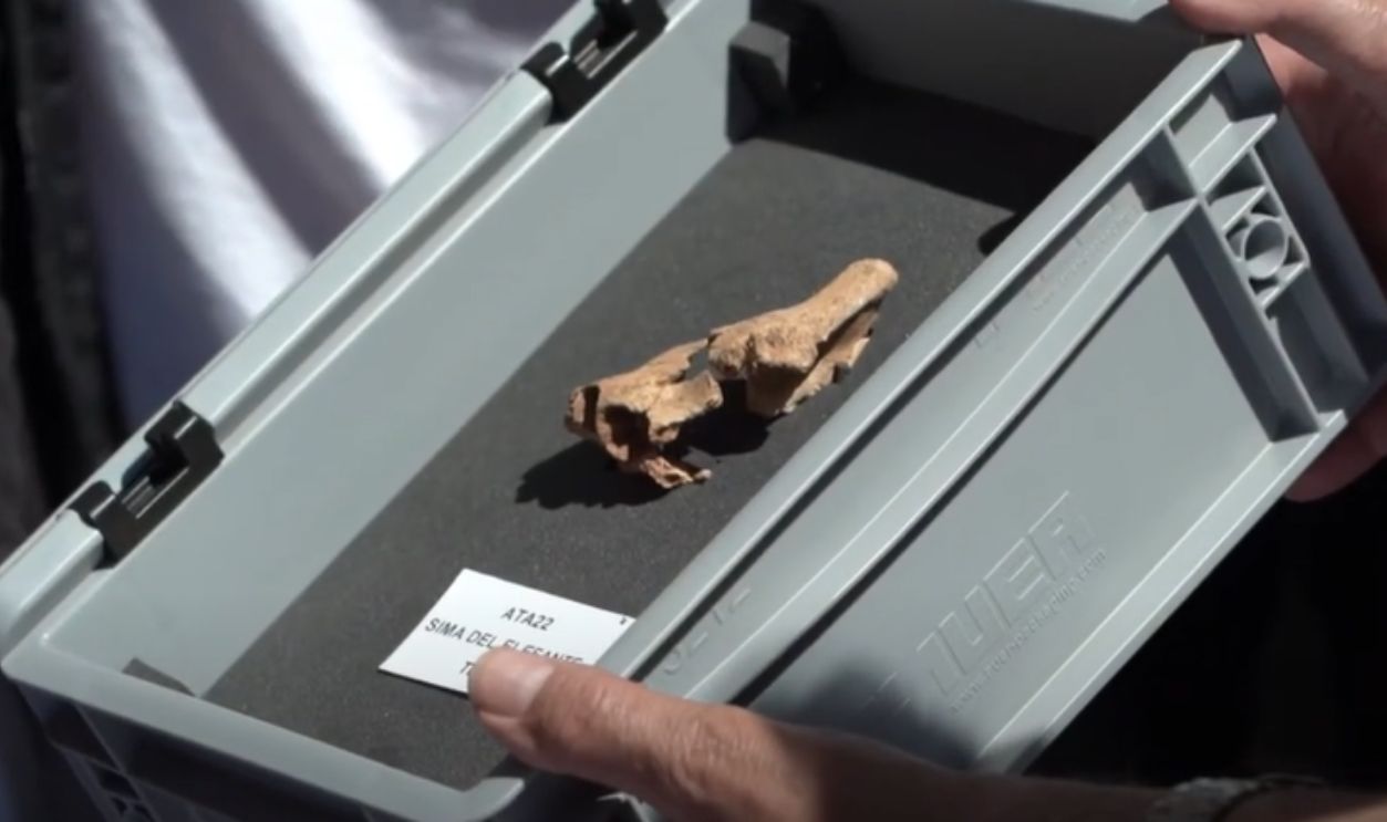 Why The Midface Matters