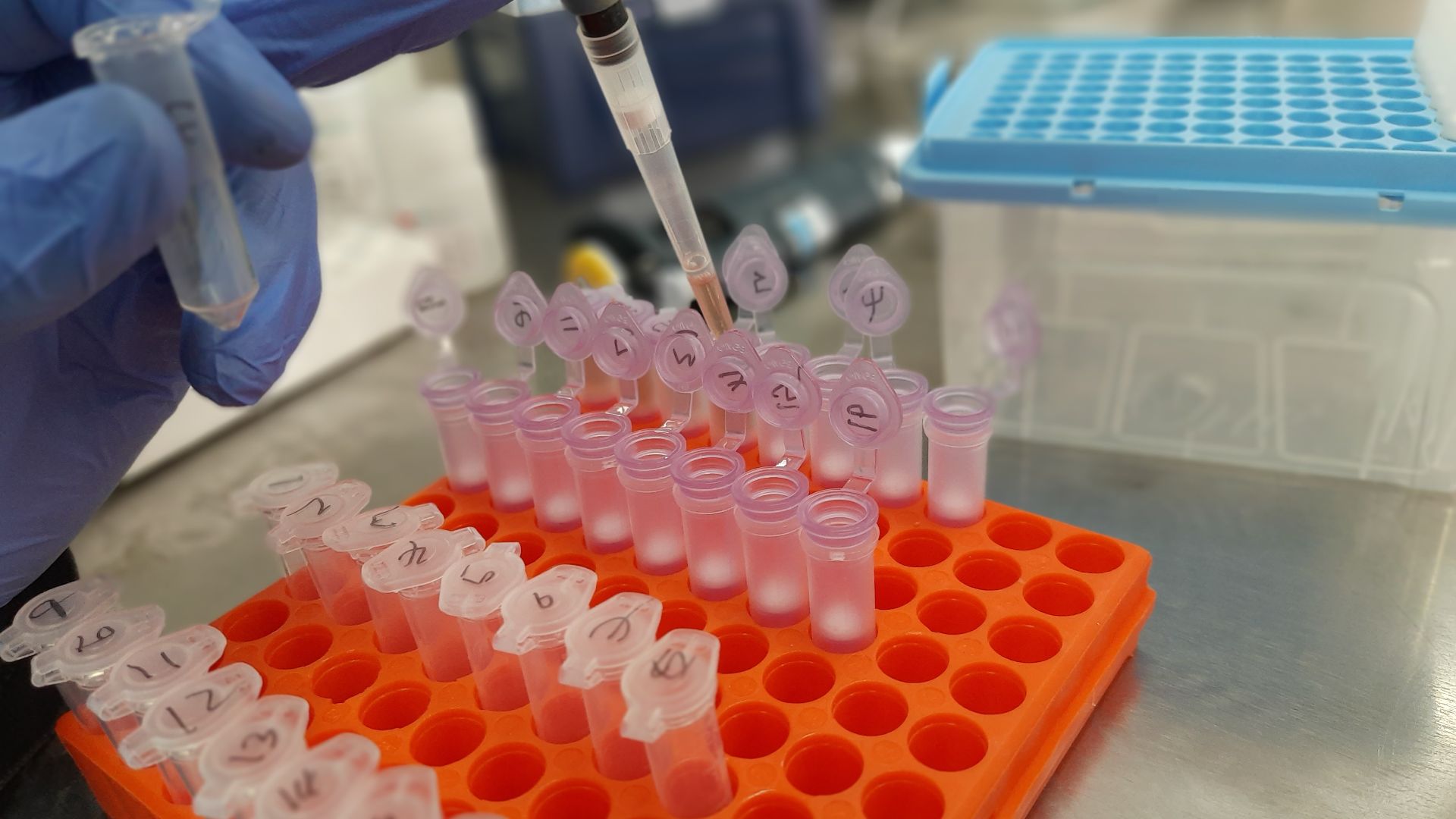 File:DNA Extraction of Bacteria.jpg