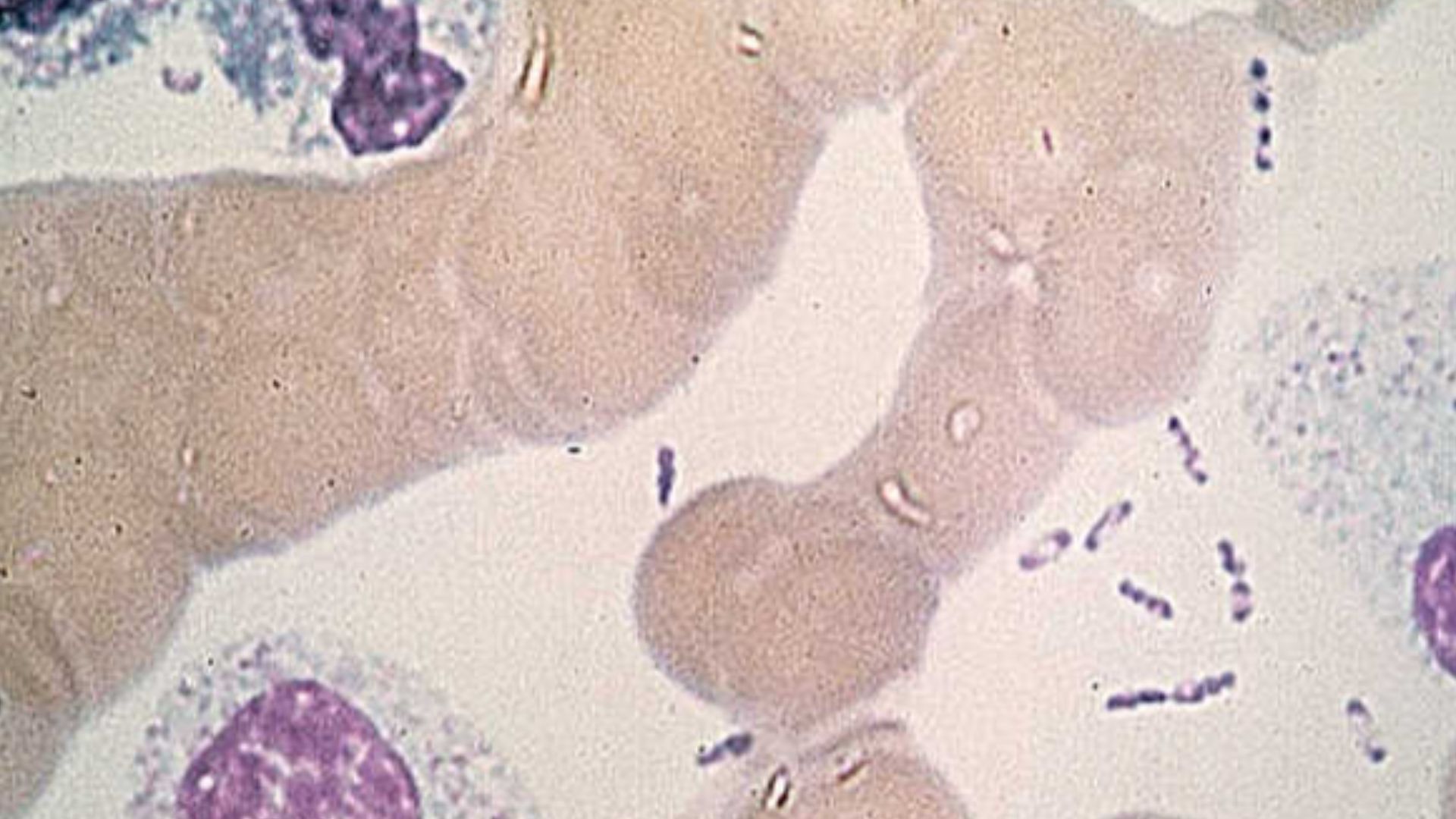 File:Yersinia pestis wayson.jpg