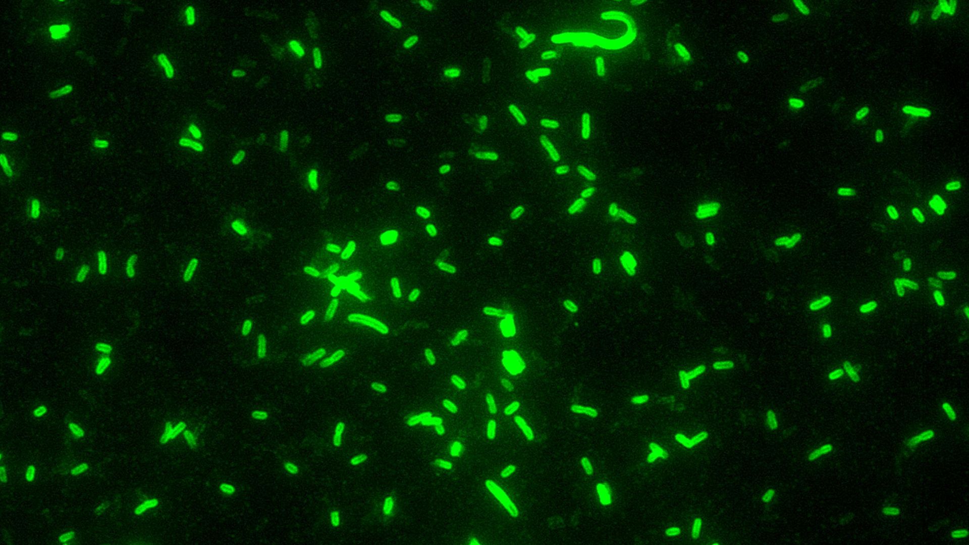 File:Yersinia pestis fluorescent - PHIL 1917.jpg