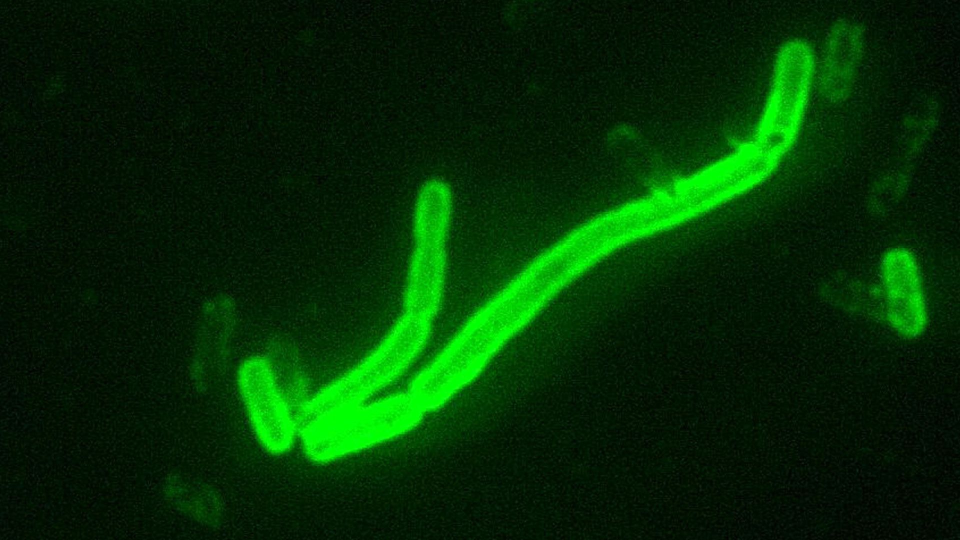 File:Yersinia pestis fluorescent.jpeg