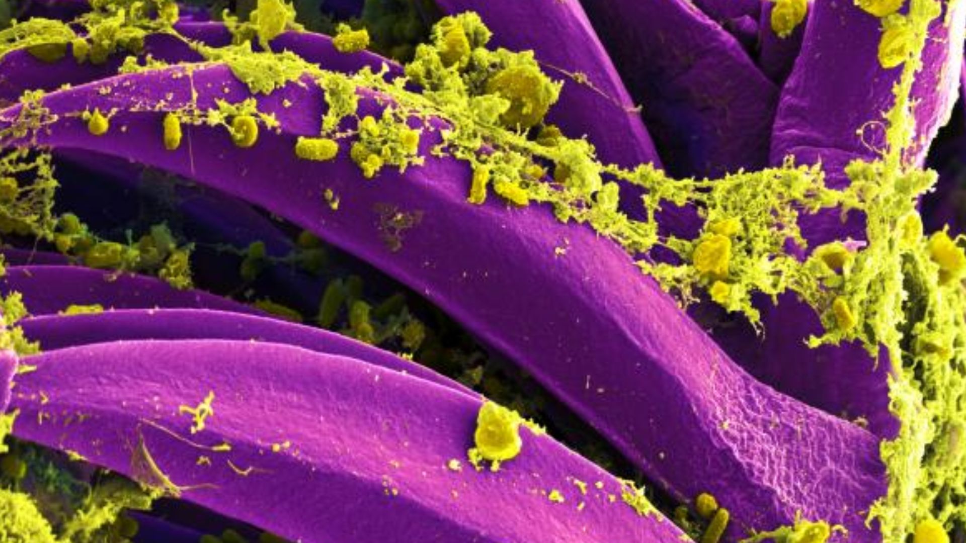 File:Yersinia pestis Bacteria.jpg