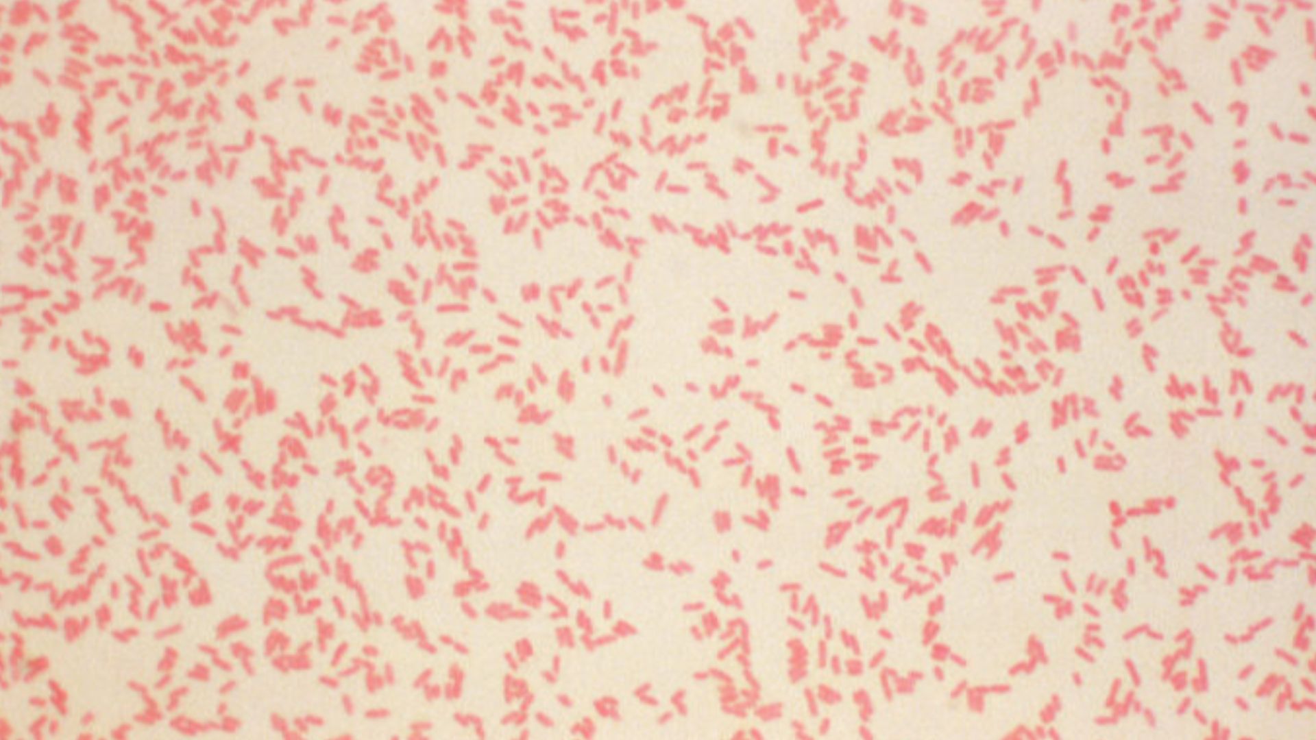 File:Yersinia enterocolitica Gram CDC 2153.jpg