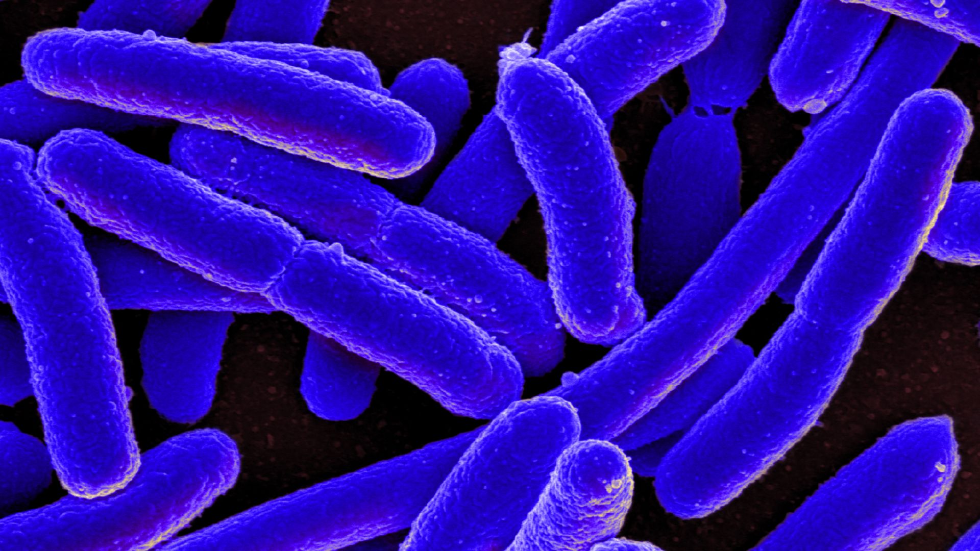 Colorized scanning electron micrograph of Escherichia coli, grown in culture and adhered to a cover slip.