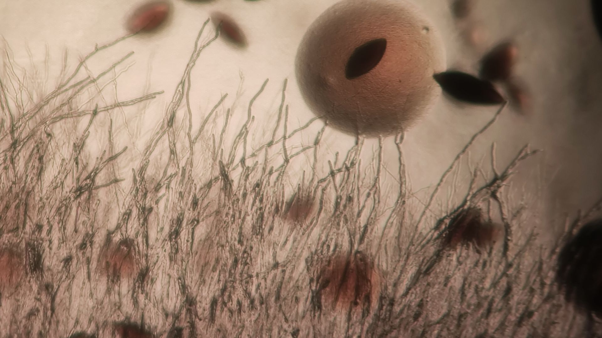 File:Bacteria yeast and fungi 03.jpg