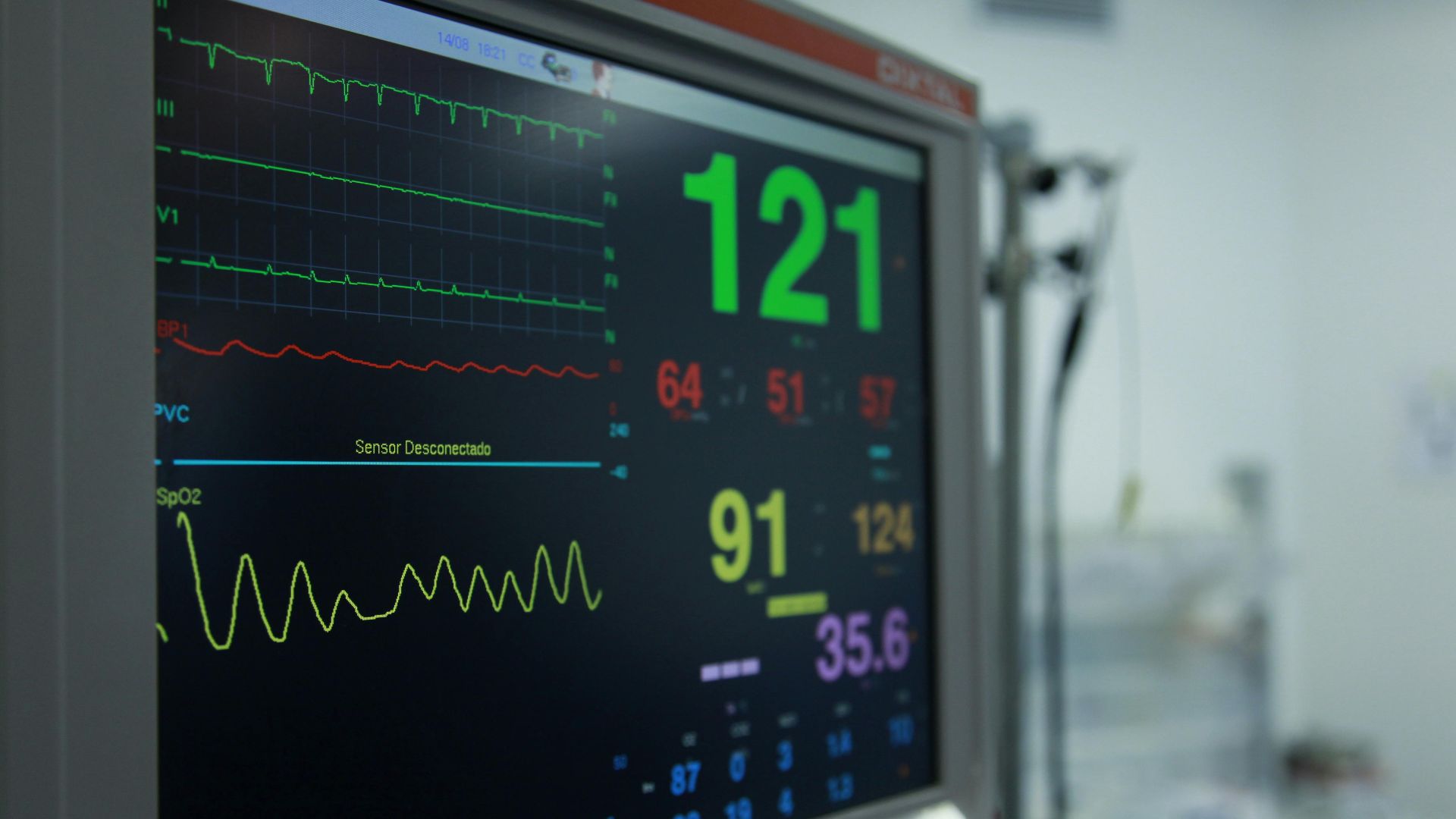 Close-up view of a vital signs monitor showing various medical readings in a hospital setting.