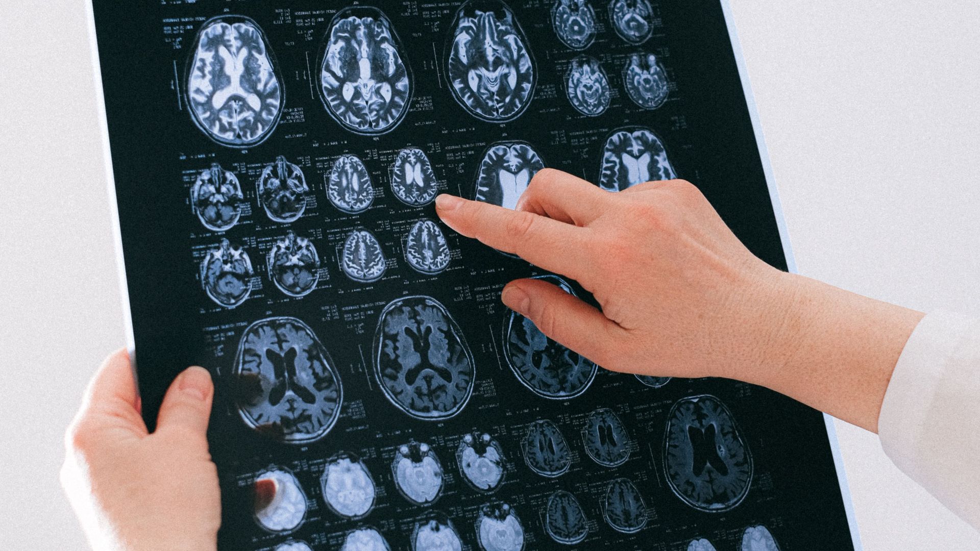 A medical professional examines a brain MRI scan, focusing on neurological health.