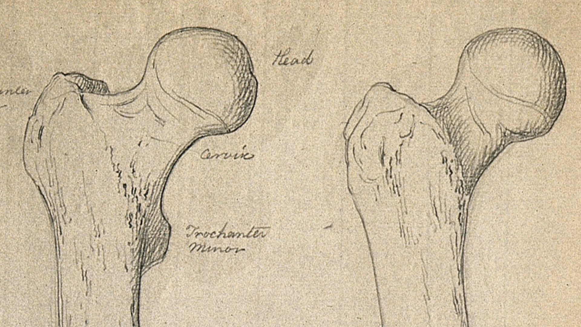 Right femur (thigh-bone), front view: two figures. Pencil drawing, ca. 1804.
Iconographic Collections