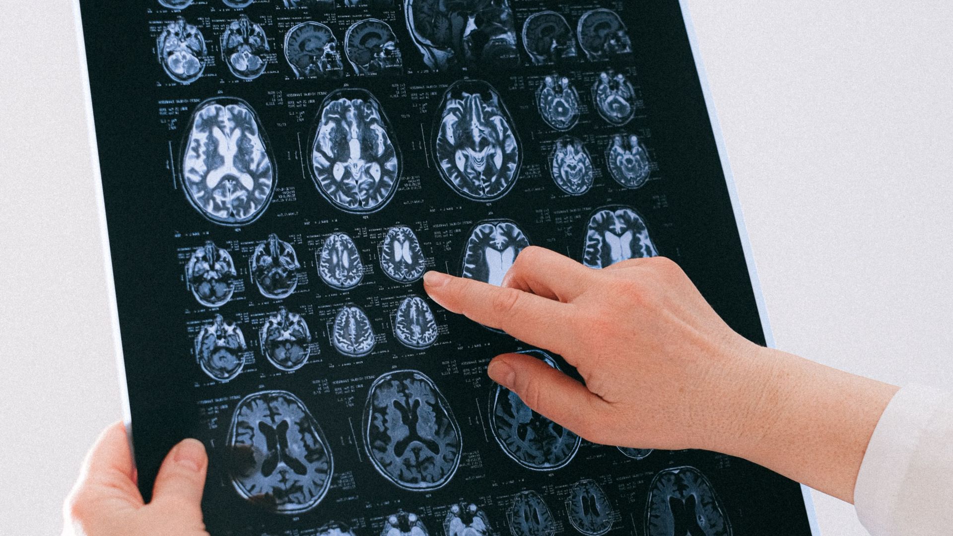 A medical professional examines a brain MRI scan, focusing on neurological health.