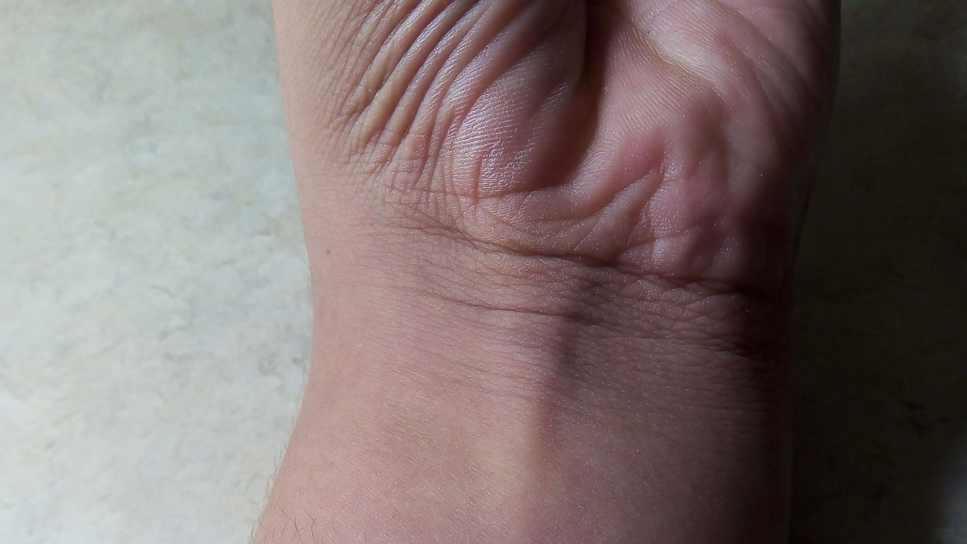 Palmaris longus in a wrist