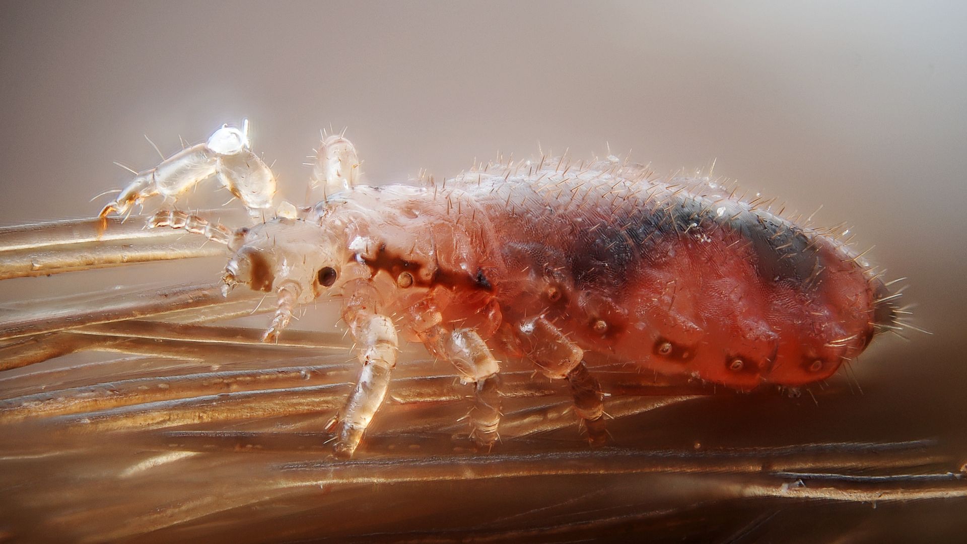 Female human head louse, Pediculus humanus capitis.
Technical settings : 
- focus stack of 46 images

- microscope objective (Nikon achromatic 10x 160/0.25) directly on the body (with adapter ~30 mm)
