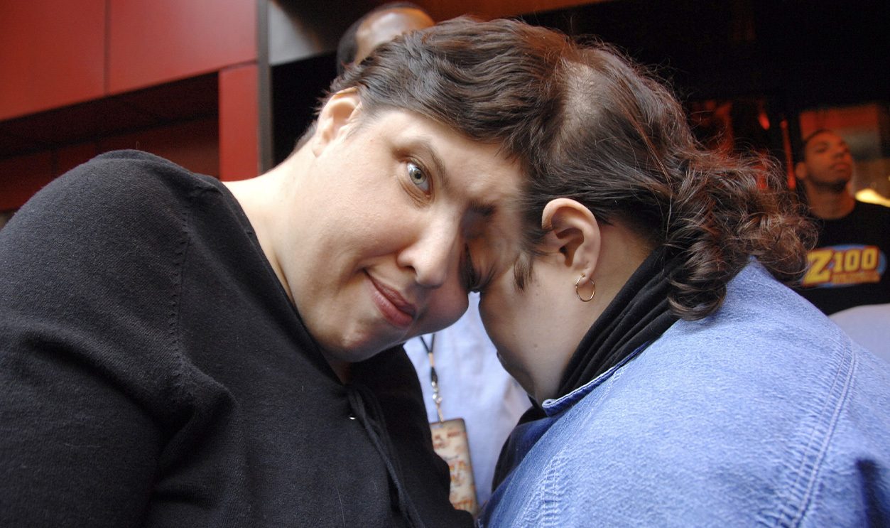 Conjoined Twins Single (1)