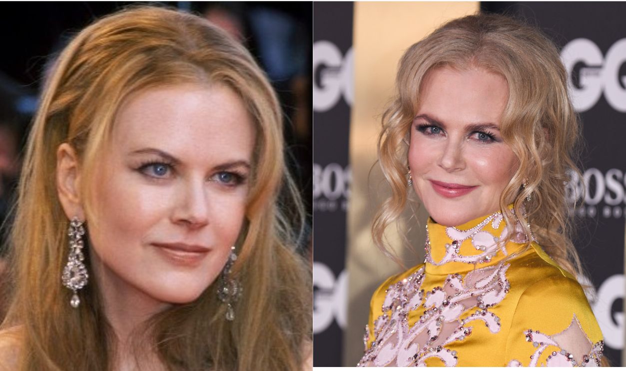 Nicole Kidman
