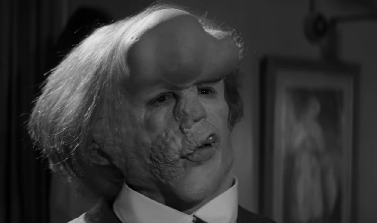 Screenshot from The Elephant Man (1980) 