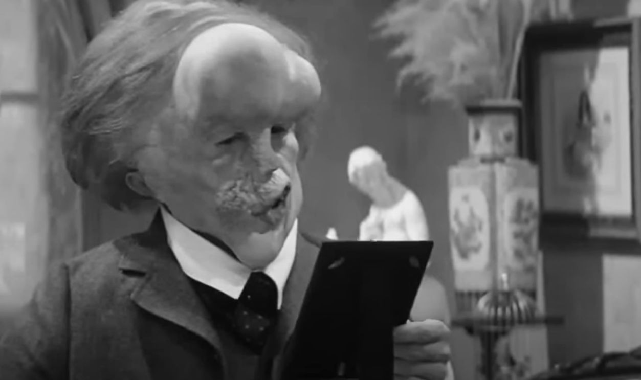John Hurt—The Elephant Man
