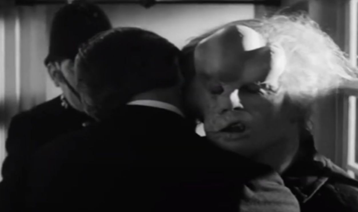 Screenshot from The Elephant Man (1980)