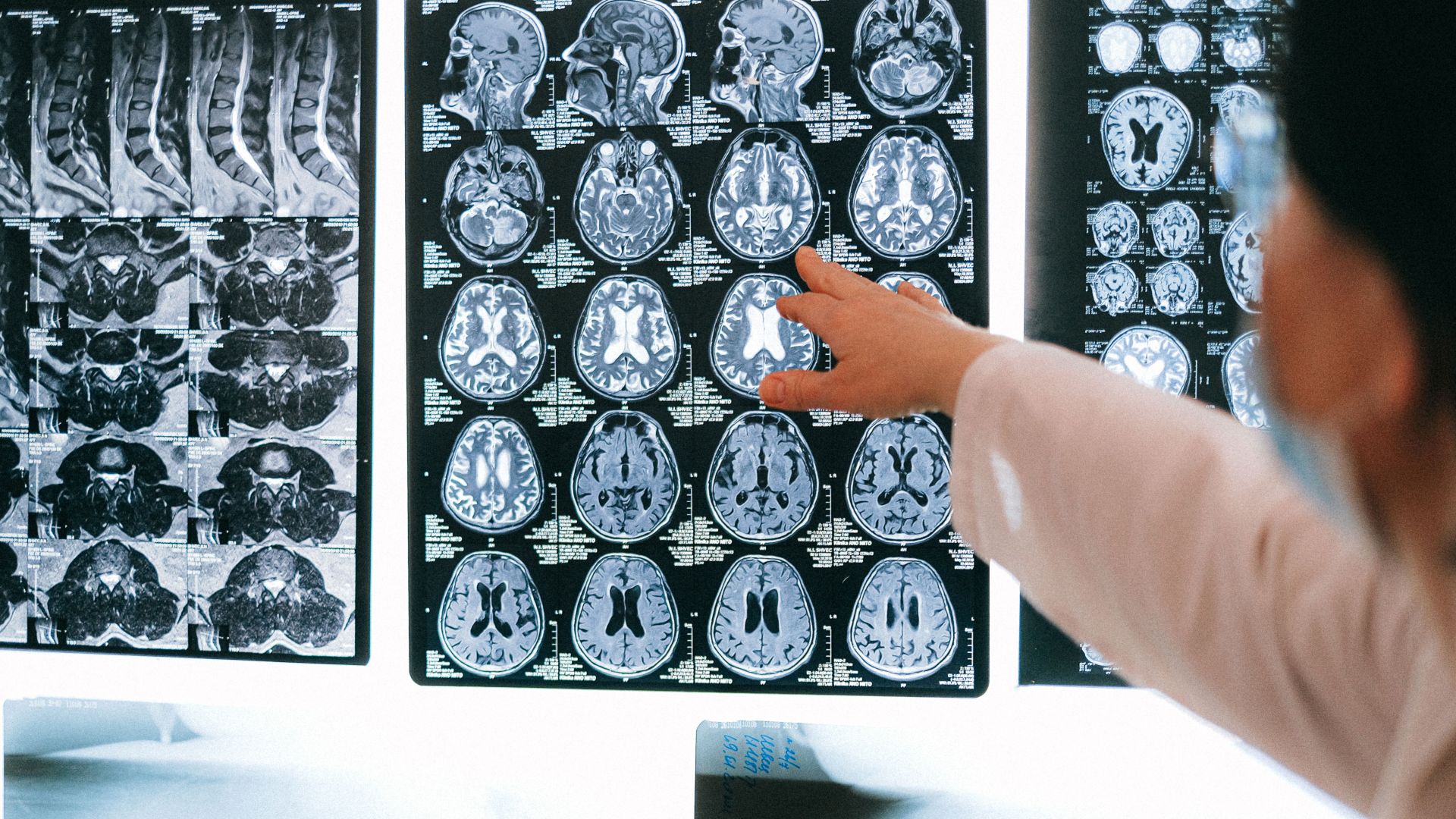 Radiologist pointing at brain MRI scans showing detailed medical examination.