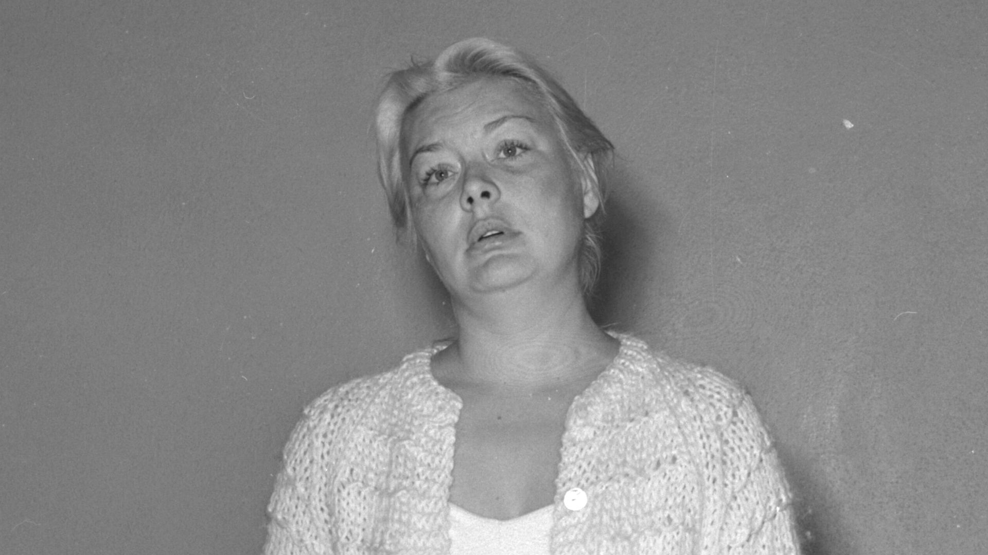 Barbara Payton at Hollywood Police Station, bruised and scarred. Los Angeles Mirror Reporter's Note: 'Barbara Payton, 35, shows up at Hollywood police station with bruises and scars but refuses to sign report or identify assailants, claiming she doesn't know them.