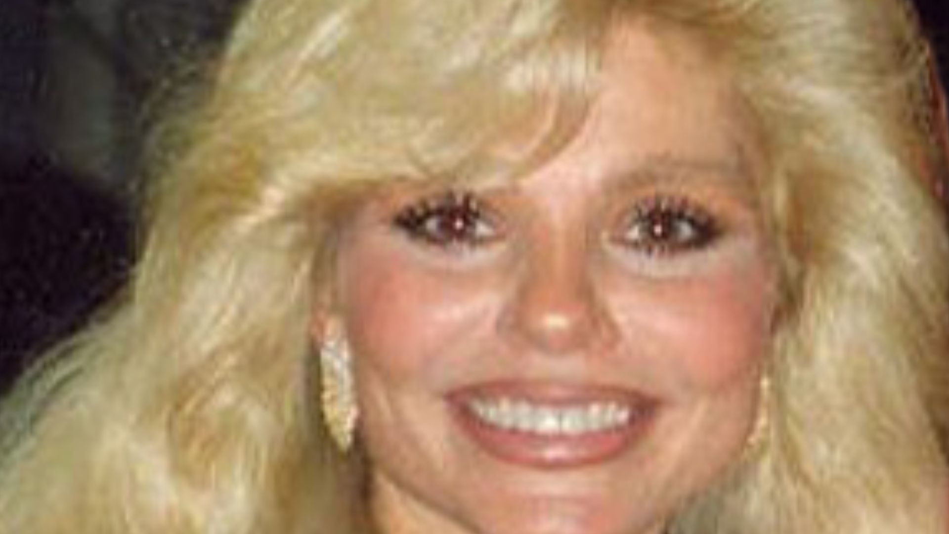 Loni Anderson