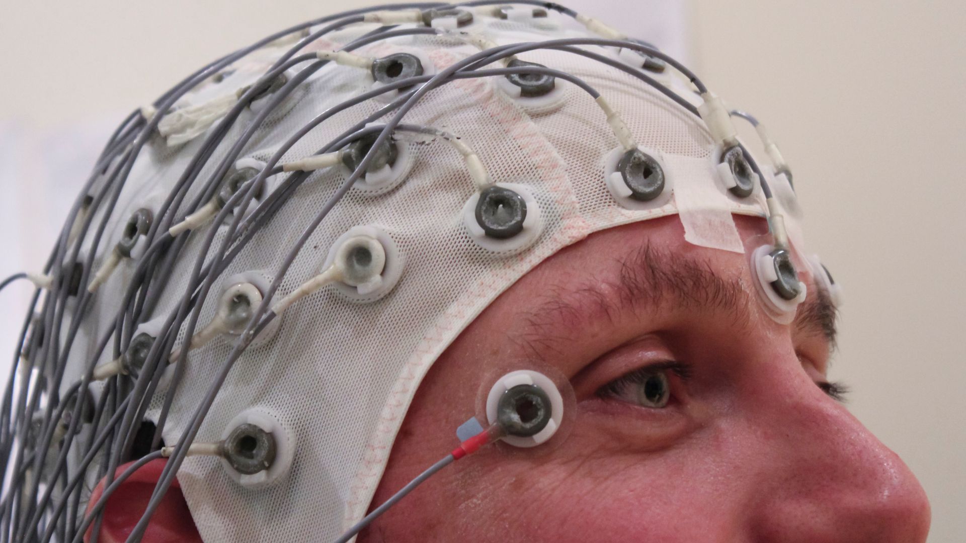 A cap holds electrodes in place while recording an EEG.