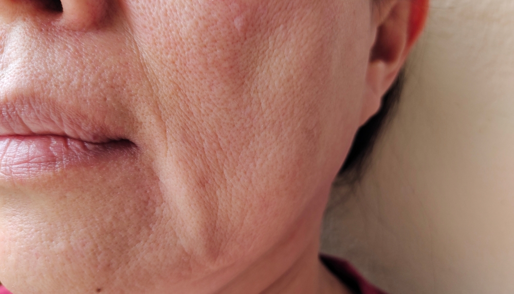 dull skin and wrinkles, rough skin and dark spots on the face